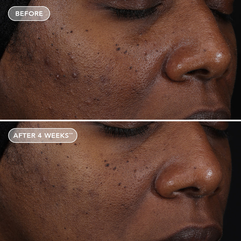 IMAGE SKINCARE AGELESS + RETINOL REPAIR CREME 0.3% RETINOL COMPLEX 1.7OZ