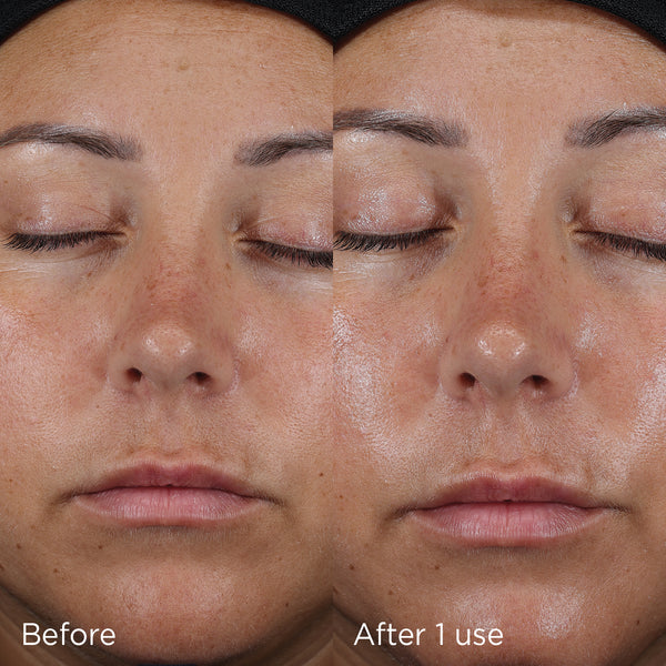 IMAGE SKINCARE Daily Prevention Ultra Defense Moisturizer SPF 50 - 1 oz (Travel Size)