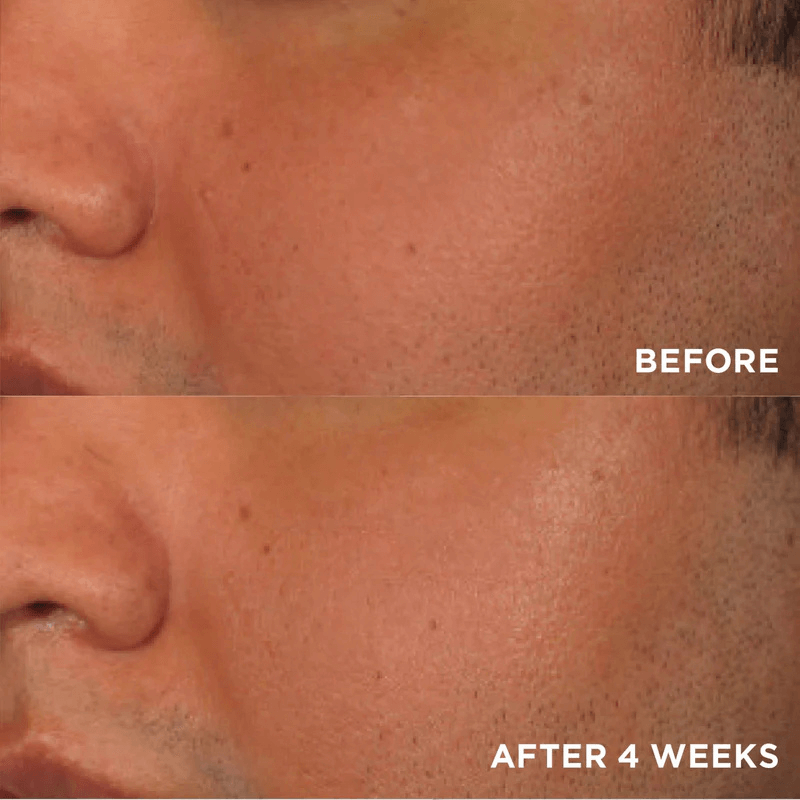 IMAGE SKINCARE VITAL C BRIGHTENING BOOST KIT